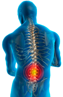 Spinal Tumors