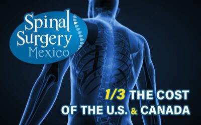 Spinal Surgery Mexico: Welcome