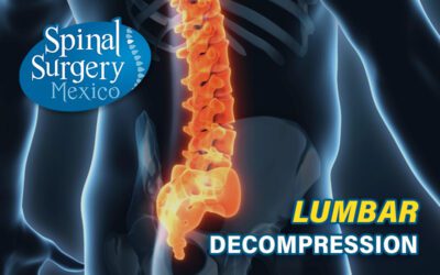 The most common type of Spine Surgery