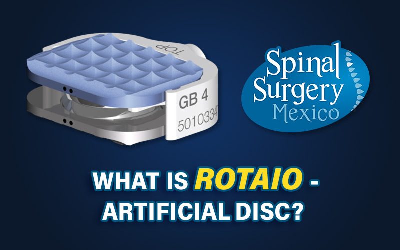 The artificial disc "Rotaio" Dr. Salmon prosthesis is manufactured by a German company with decades of research and a rich history.
