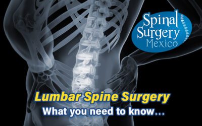 Lumbar Spine Surgery
