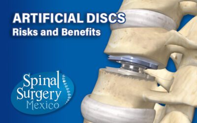 Artificial Disc (AD)